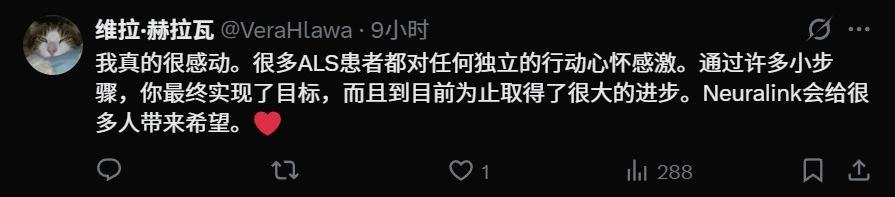 刚刚,马斯克切脑全场震撼!插脑只要1.5秒,26年治愈失明,28年全人类变AI