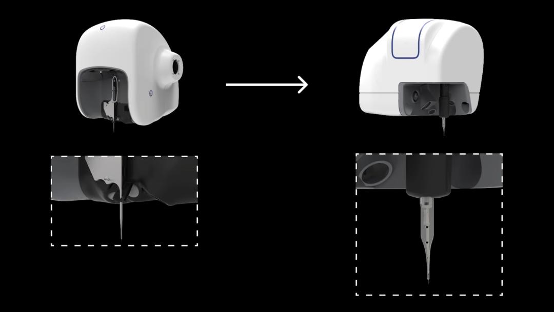 刚刚,马斯克切脑全场震撼!插脑只要1.5秒,26年治愈失明,28年全人类变AI