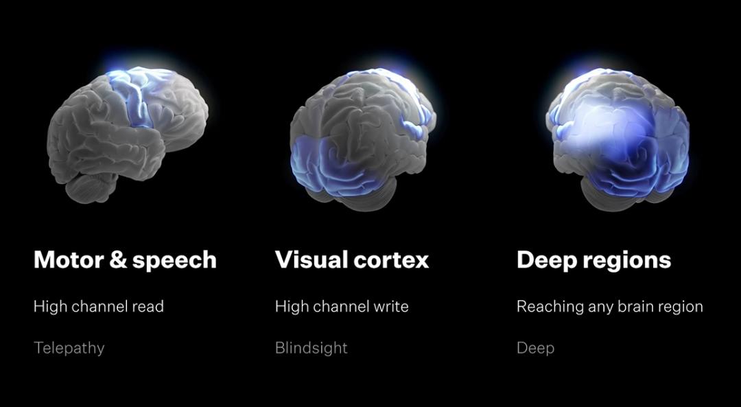 刚刚,马斯克切脑全场震撼!插脑只要1.5秒,26年治愈失明,28年全人类变AI