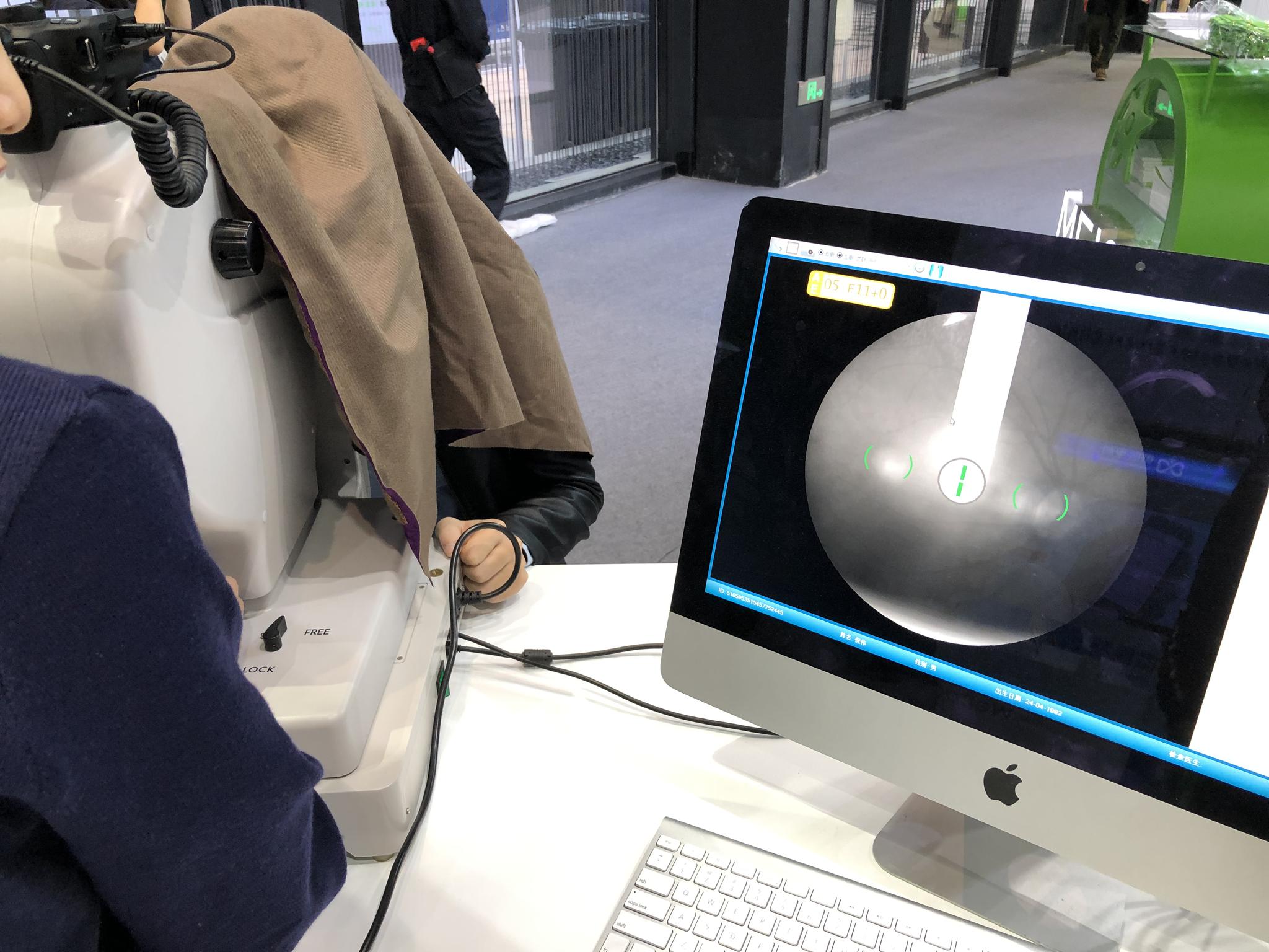 几分钟采集眼球数据，分析眼部疾病