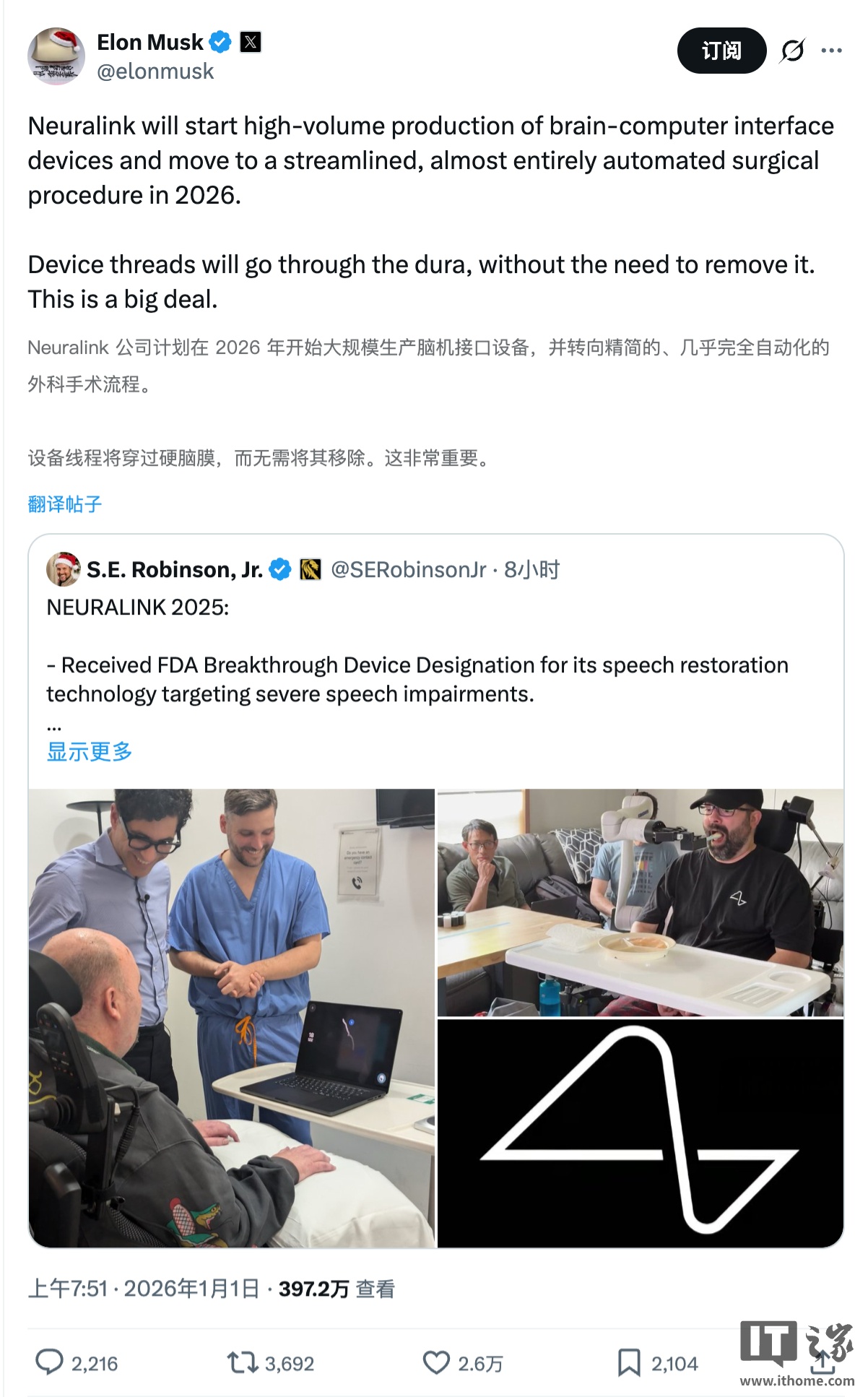 马斯克：2026 年将“大规模生产”脑机接口设备