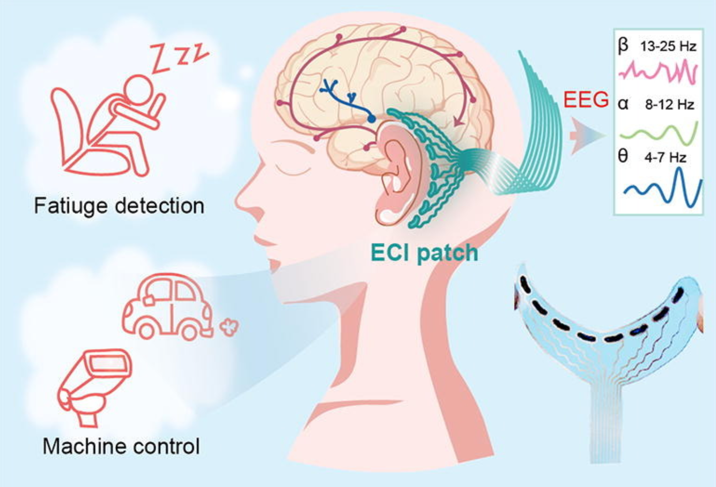 耳后脑机接口贴片问世：北理工、北航团队打造，连续佩戴 10 小时稳定使用
