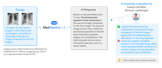 谷歌发布医疗 AI 模型 MedGemma 1.5 4B：可本地部署，CT、MRI 都能处理