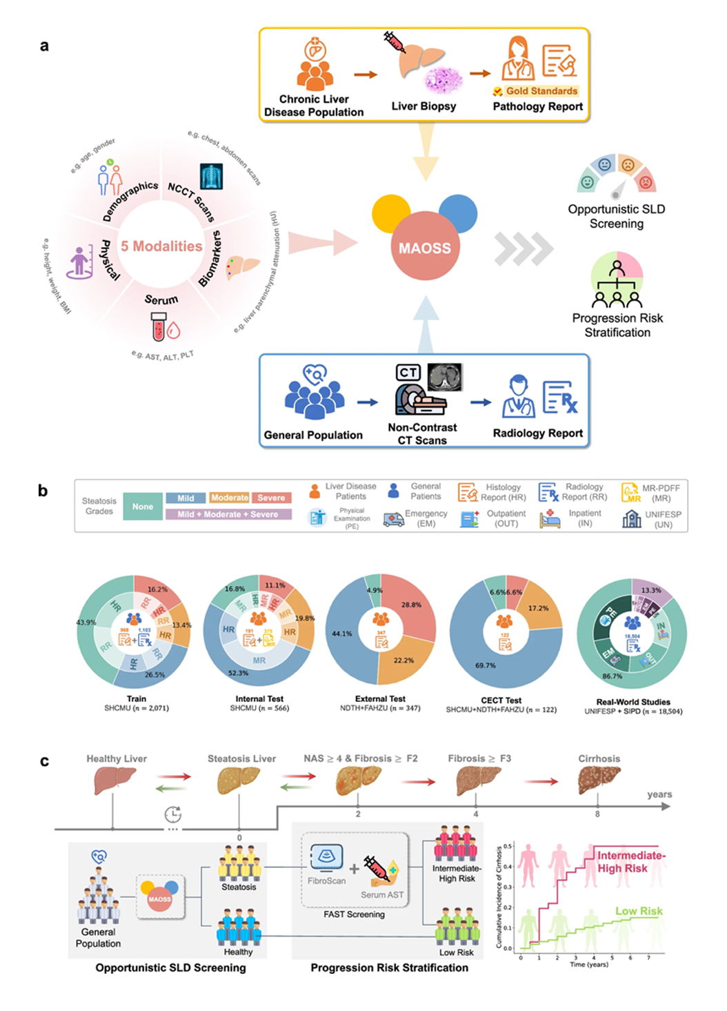 阿里达摩院发布脂肪肝筛查 AI 模型 MAOSS，高风险人群检出率提升 2 倍