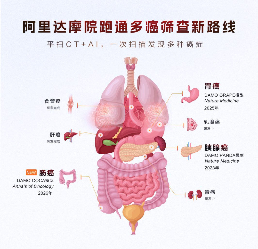阿里达摩院 AI 全球首次实现肠癌“无感”检测，登上国际肿瘤学顶刊